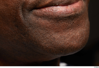 HD Face Skin Quintrell Wheeler chin lips mouth skin pores…